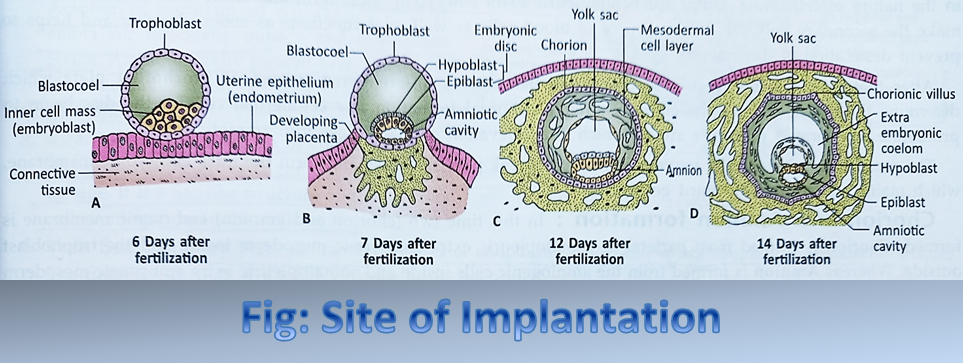 Site of Implantation in Uterus