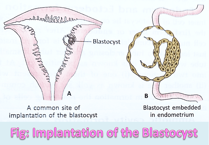 Site of Implantation in Uterus